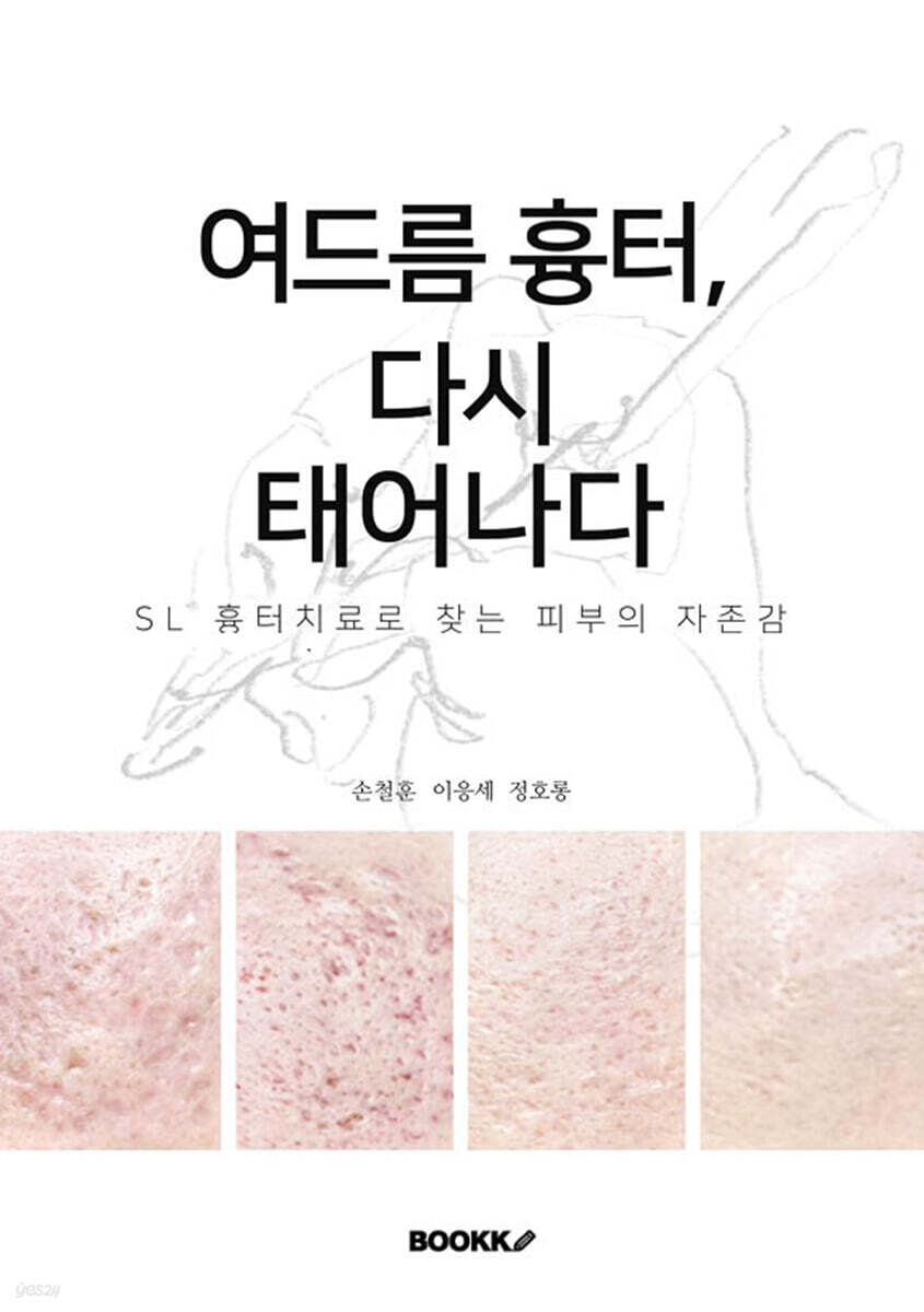여드름 흉터의 한의학적 해법 제시 ‘여드름 흉터, 다시 태어나다’ 출간